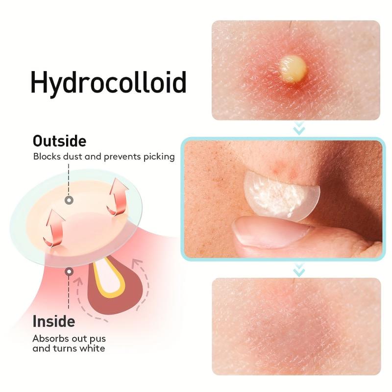 Acne Cover Patch Hydrocolloid Pimple Zit Blemish Stickers