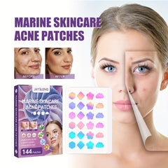 Acne Covering Patch Blemish Spot Cover Hydrocolloid Acne Tape 144pcs