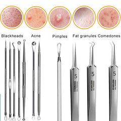 11Pcs Ingrown Hair Tweezers Acne Blackhead Removal Needles Pore Cleaner