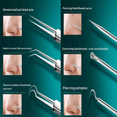 11Pcs Ingrown Hair Tweezers Acne Blackhead Removal Needles Pore Cleaner
