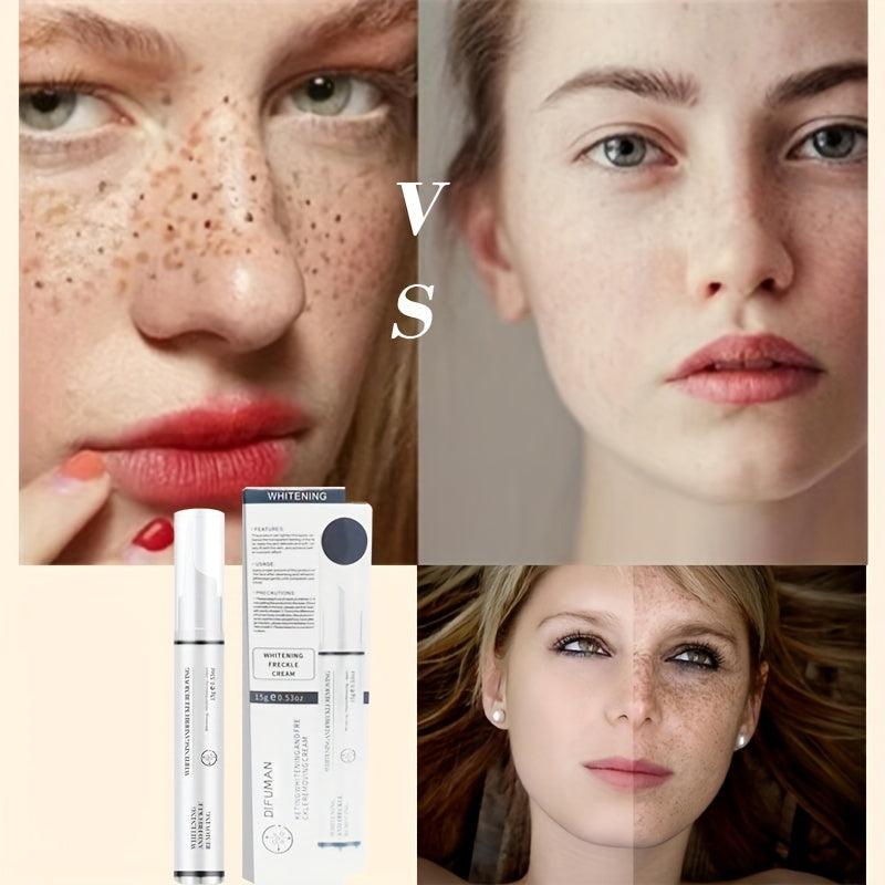 15g Freckle Improving Cream Moisturize Skin Reduce Spots & Freckle