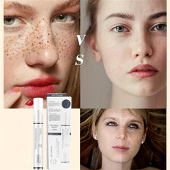 15g Freckle Improving Cream Moisturize Skin Reduce Spots & Freckle