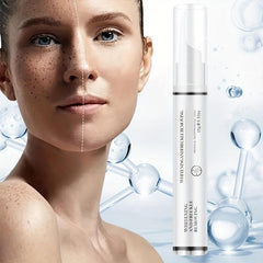 15g Freckle Improving Cream Moisturize Skin Reduce Spots & Freckle