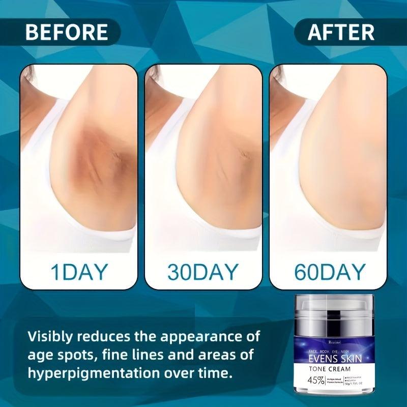 Even Skin Tone Moisturizer Cream