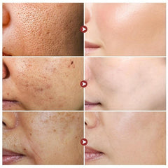 Facial Serum with Hyaluronic Acid VE for Pore Shrinkage