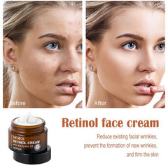 30g Retinol Face Cream Fine Lines Firming Skin Moisturizing Elasticity