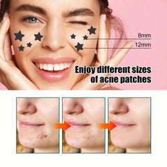 Star Shaped Acne Patch - Hydrocolloid Pimple Cover Patch