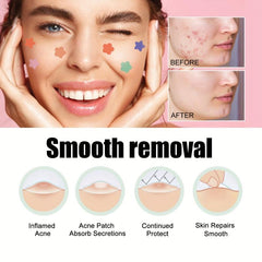 Colorful Acne Patches Tea Tree Portable Invisible Acne Patch