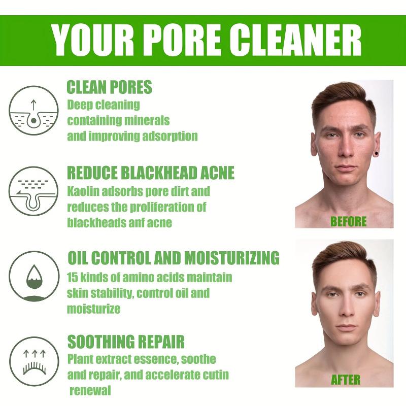 Mild Amino Acid Mask Acne Removing Blackheads Facial Clay Mask