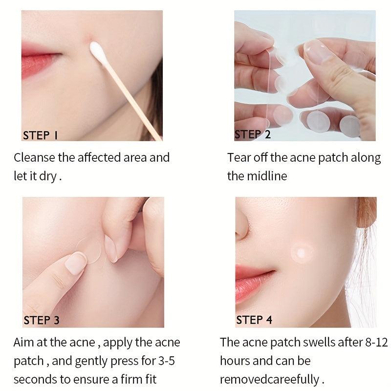 Acne Patches for Face and Skin, Gentle and Effective