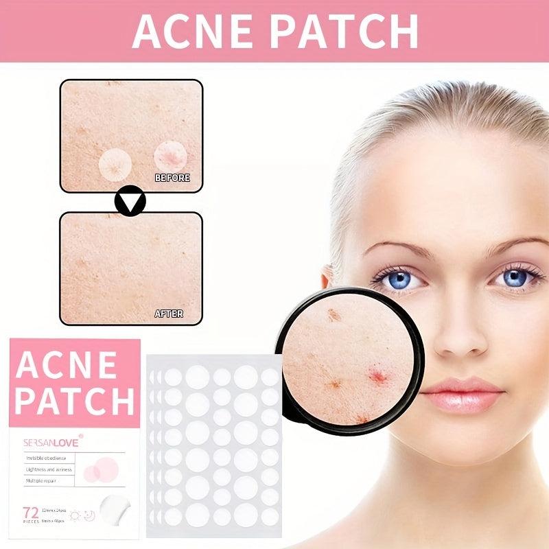 Acne Patches for Face and Skin, Gentle and Effective