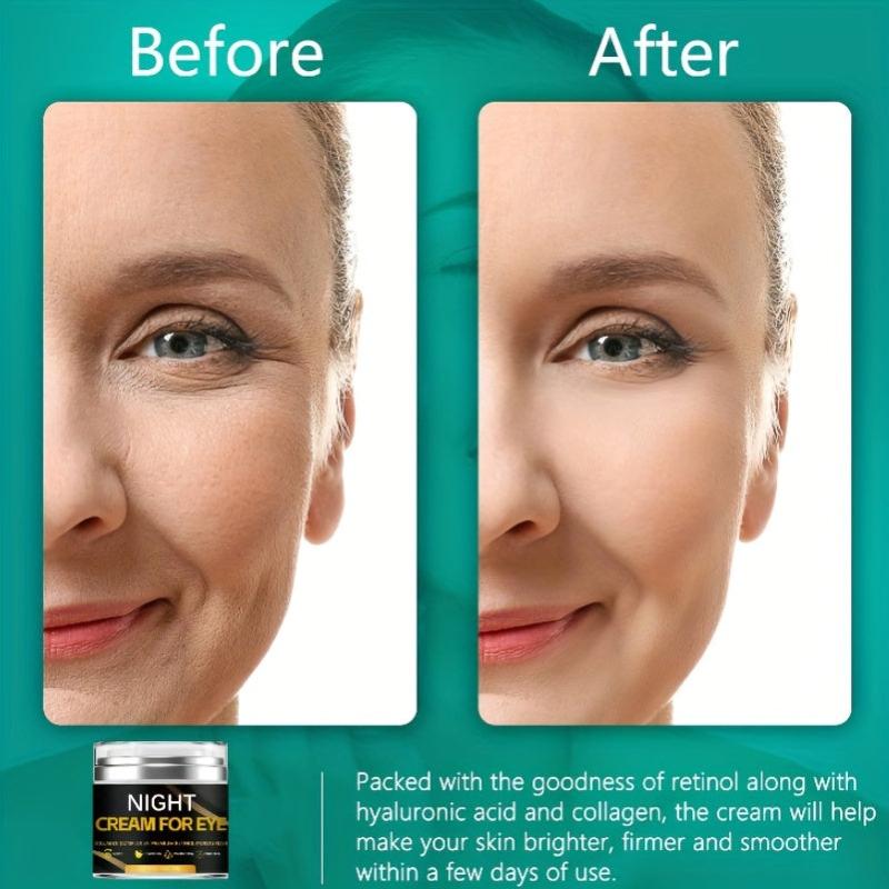 Advanced Eye Cream for Dark Circles and Puffiness