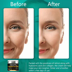 Advanced Eye Cream for Dark Circles and Puffiness