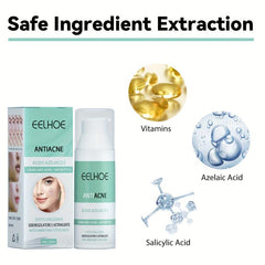 Acne Ointment w/Salicylic & Azelaic Acid 30ml