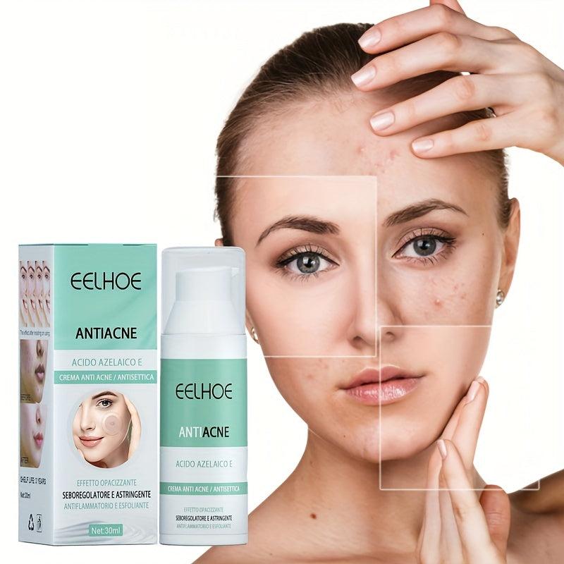 Acne Ointment w/Salicylic & Azelaic Acid 30ml