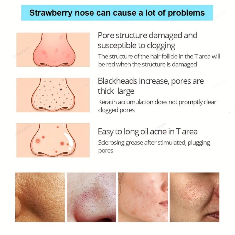 50pcs Blackhead Remove Mask Peel Deep Cleansing Shrink Pore Nose Head
