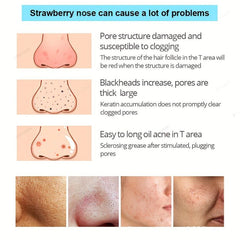 50pcs Blackhead Remove Mask Peel Deep Cleansing Shrink Pore Nose Head