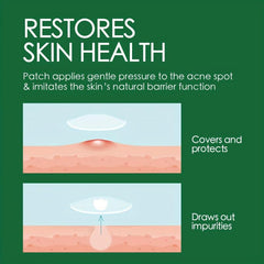 10pcs Invisible Acne Patch - Makeup Fri