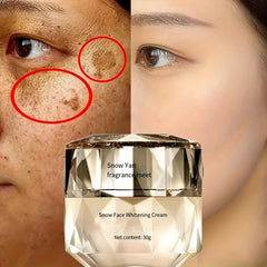 30g Spot Cream - Sunburn Melasma Freckles Age Spots Dark Spots