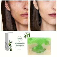 Jojoba & Tea Tree Exfoliating Soap Acne Dark Spots Circles Pores
