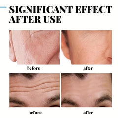 Wrinkle Diminishing Cream with Collagen & Hyaluronic Acid