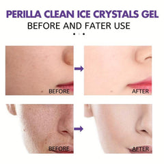 Perilla Clean Gel Cream Cleanser Facial Cleansing Pore Softens Skin Wash