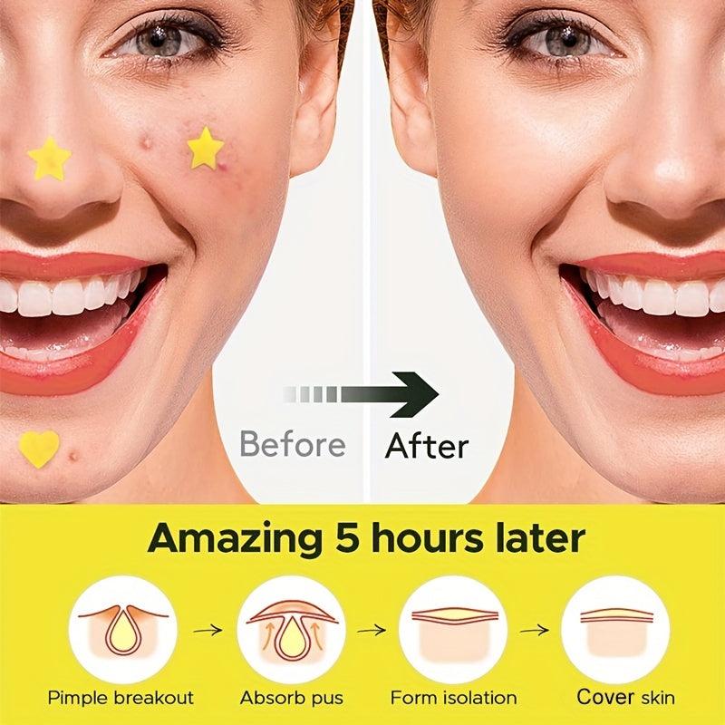 Heart & Star Acne Patch Set Hydrocolloid Cover Zit Dots Tea Tree