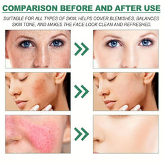 100g Correction Care Cream Fade Spots Sun Repair Hydration Moisturizing