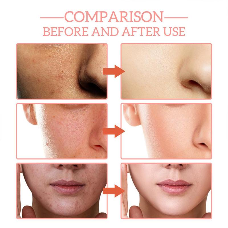5-In-1 Face Serum for Firming Skin & Reducing Wrinkles
