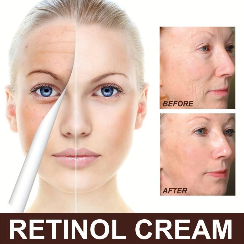 Retinol Cream with Collagen Repair - Wrinkle Smoothing Night Moisturizer