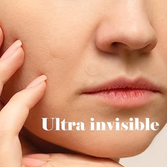 Hydrocolloid Acne Patches for Face - Cover Zits & Blemishes - 360pcs