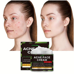 55ml Salicylic Acid Acne Cream Blackhead Remover