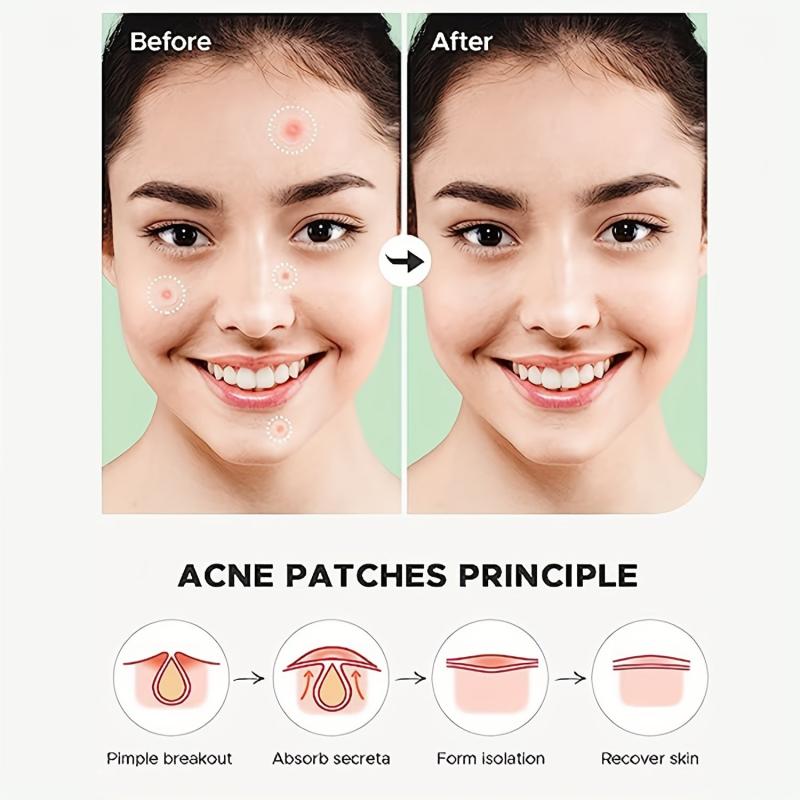 Acne Patches Hydrocolloid Acne Pimple Patch For Covering Zits And Blemishes