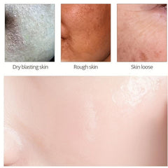 30ml Hyaluronic Acid Face Cream - Skin Moisturizing and Repairing Formula