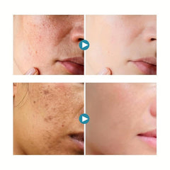 30ml Hyaluronic Acid Face Cream - Skin Moisturizing and Repairing Formula