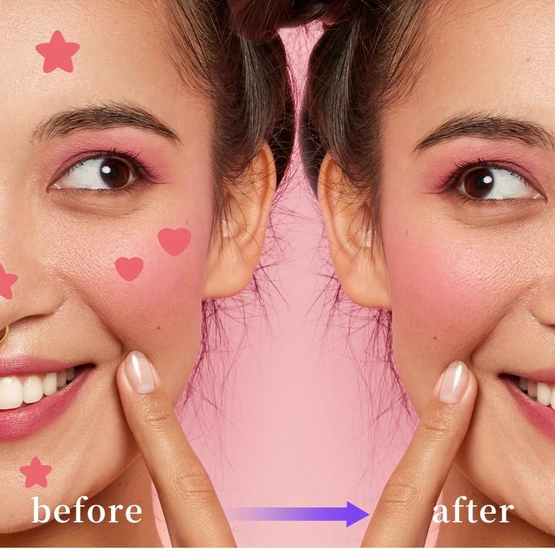 Star Shape Acne Patch 3pcs 72 Patches Breathable Effective Acne Remover