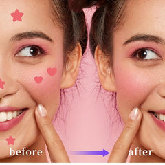 Star Shape Acne Patch 3pcs 72 Patches Breathable Effective Acne Remover