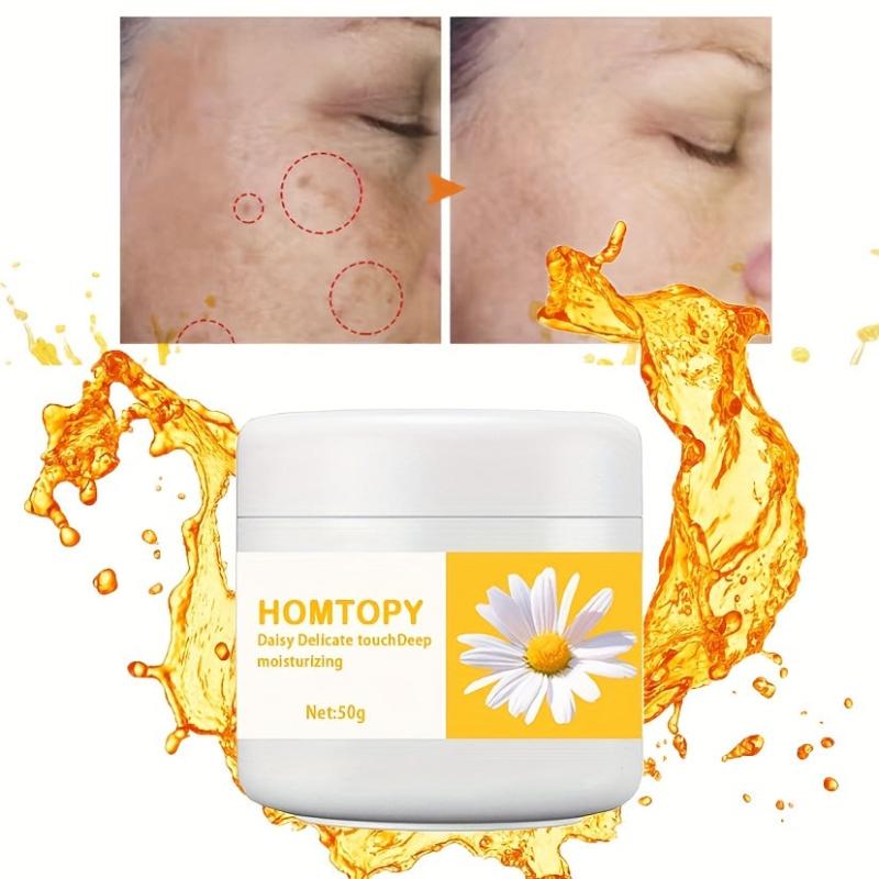 50g Spot Cream for Melasma Stains Sunburn Freckles