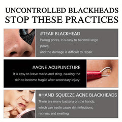 Blackhead Mask for Clear Skin & Pore Control