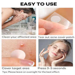 Acne Pimple Patch for Covering Zits and Blemishes Spot Stickers