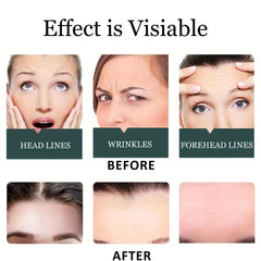 10Pcs Forehead Wrinkle Patches Face Tape Smooth Fine Lines Natural Skin Care