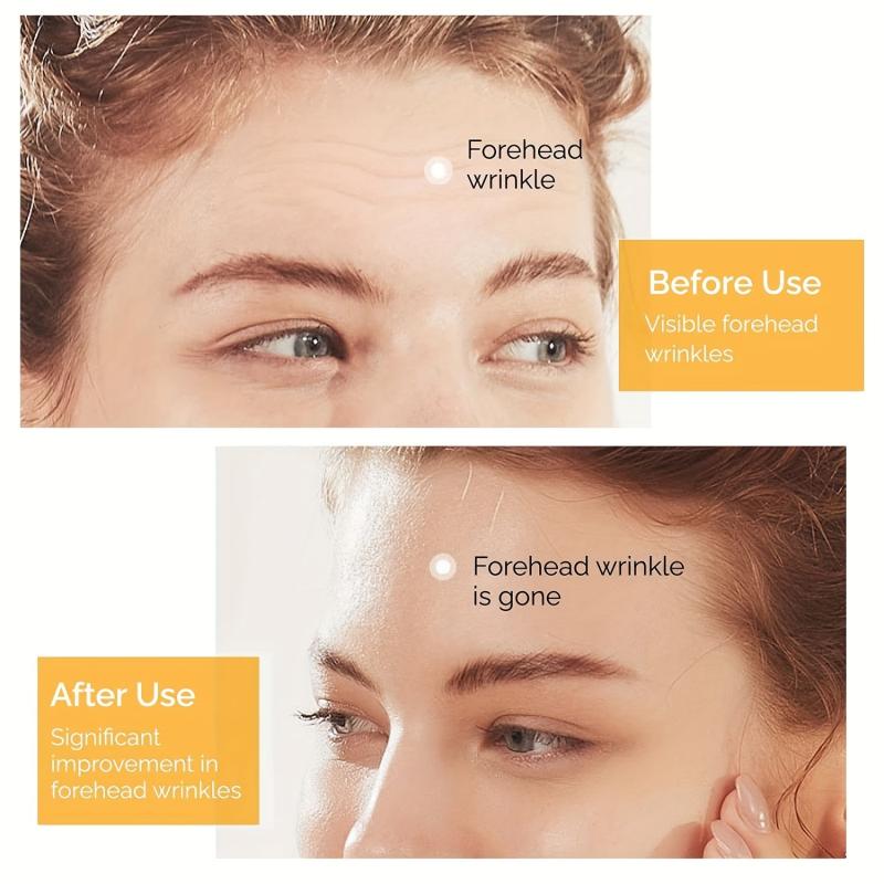 10Pcs Forehead Wrinkle Patches Face Tape Smooth Fine Lines Natural Skin Care