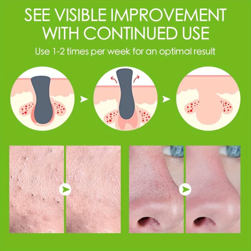 Strawberry Nose Mask for Deep Cleansing and Pore Shrinkage