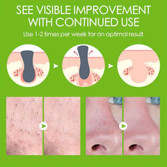Strawberry Nose Mask for Deep Cleansing and Pore Shrinkage