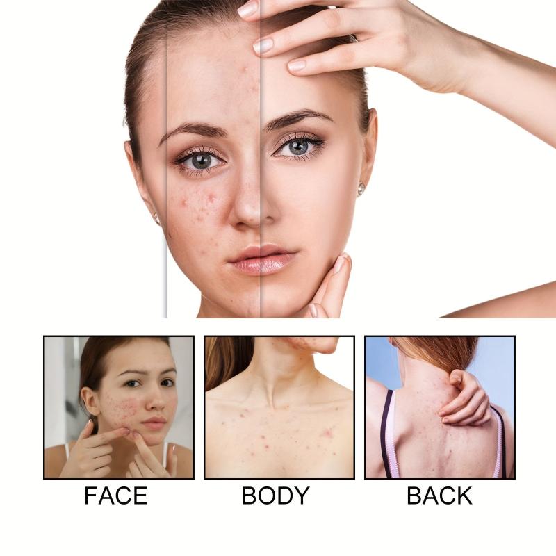 60pcs Colorful Acne Patches Hydrocolloid Spots Blemishes Cover Pimples Zits