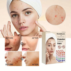 60pcs Colorful Acne Patches Hydrocolloid Spots Blemishes Cover Pimples Zits