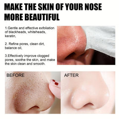 Blackhead Remover Mask 30ml Face Clean Pores Acne Nose Sticks