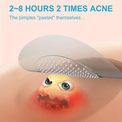 18 Microdarts Acne Patch Hydrocolloid Acne Cover Stickers
