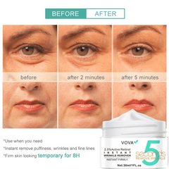 Wrinkle Remover Cream for Smooth Skin