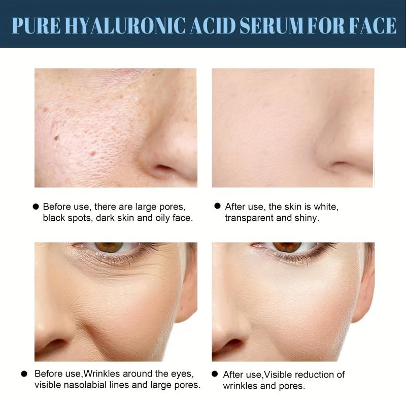 Protein Lifting Threading Set With Collagen Serum